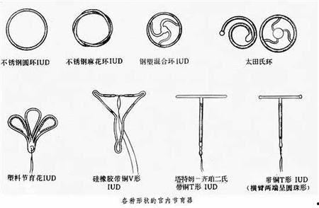 微博网红科普上环了吗,上环了吗？带你了解避孕环的奥秘